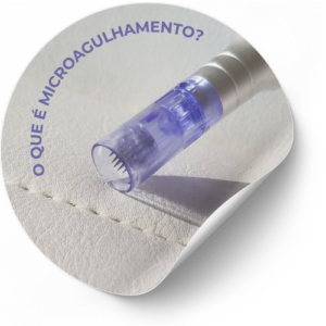 Microagulhamento